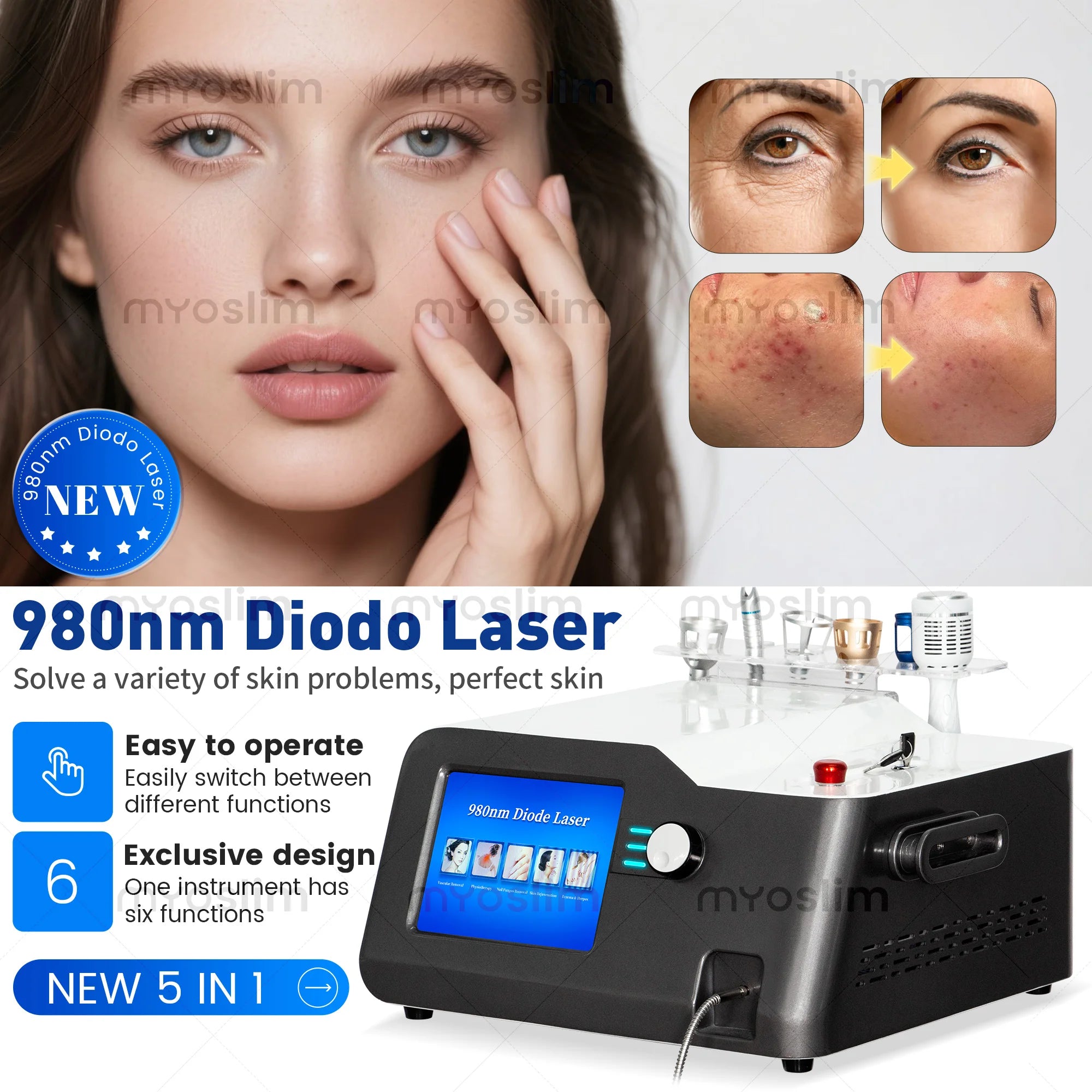 980Nm Laser Diode Vascular Spider Varicose Vein Removal Machine Treatment Fungi Physiotherapy For Nail Lipolisi Commercial Salon
