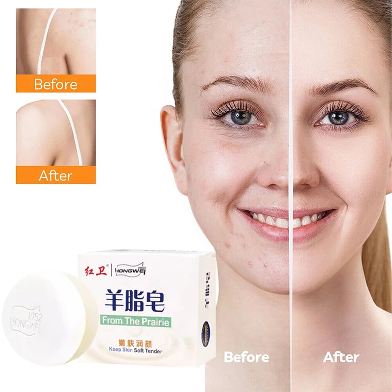 Handmade Lanolin Facial Soap Brighten Face Wash Soothing Facial Cleanser Moisturizing Oil Control Exfoliating Body Bathing Soap