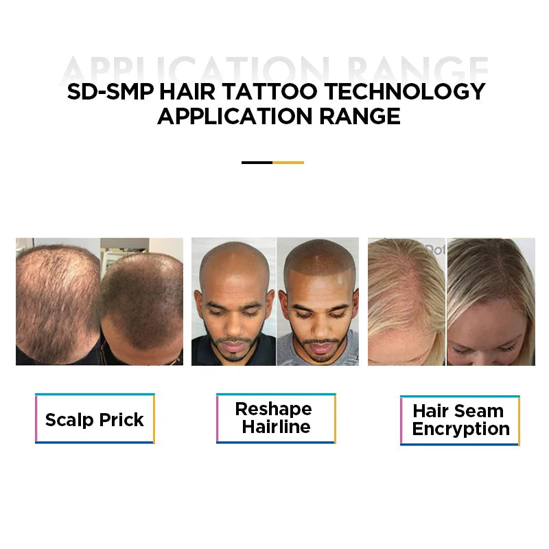 High Quality Electric SMP Tattoo Kits Rechargeable Hair Tattoo Scalp Micropigmentation Machine Hair Tattoo Machine